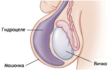 Осмотр ребенка после операции на яичках