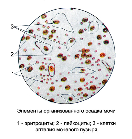 Элементы осадка мочи