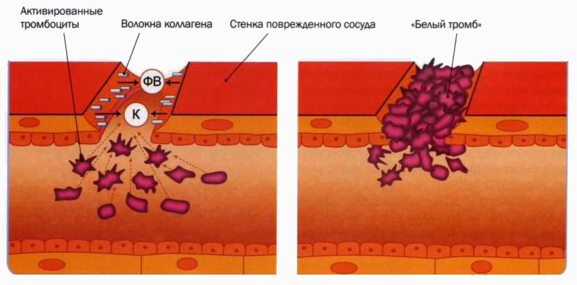 Формирование тромба