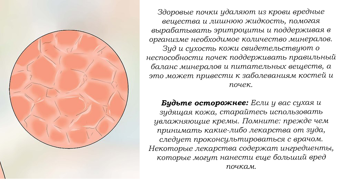 Удали почку. Как понять что проблемы с почками. Как проявляются проблемы с почками. Признаки проблем с почками.