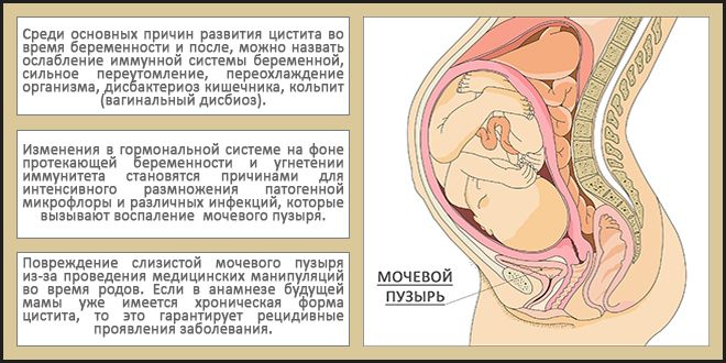 Причины воспаления