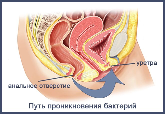 путь попаданий