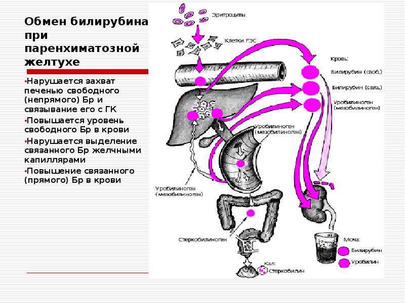 Билирубин. Обмен билирубина. Прямой билирубин при паренхиматозной желтухе. Желчный пузырь билирубин. Повышение прямого билирубина причины.