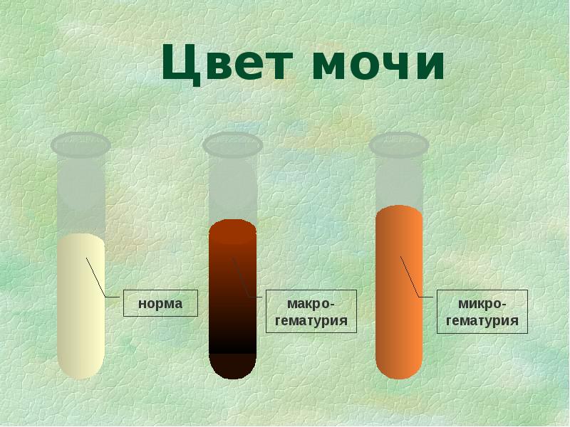 Какая должна быть моча у здорового человека цветом фото