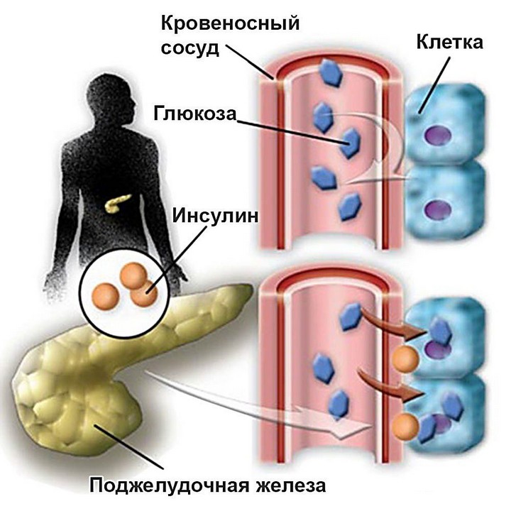 Бета-клетки и собственный инсулин