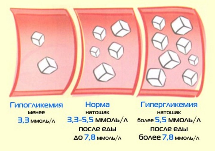 анализ крови на сахар