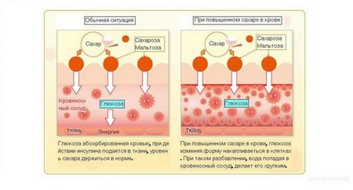 глюкоза в крови