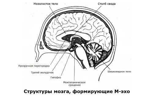 Структуры, формирующие М-эхо