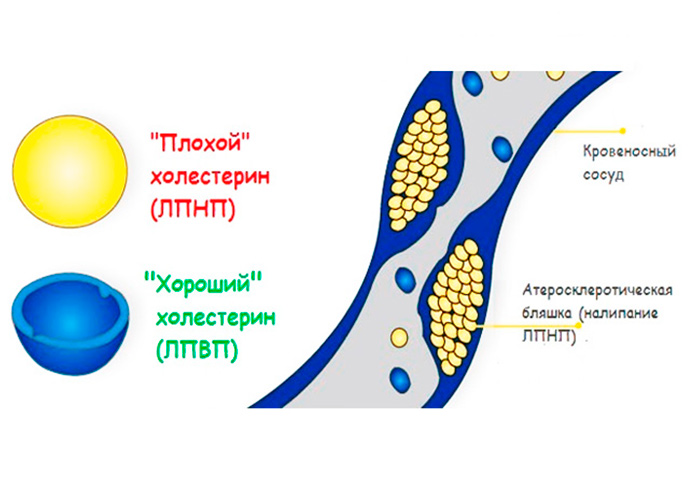 Хороший и плохой холестерин