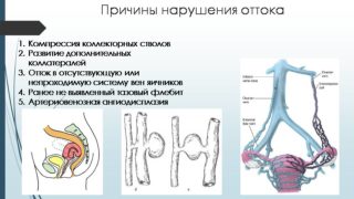 Застой крови в малом тазу у женщин и мужчин: симптомы, лечение, причины