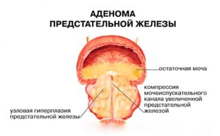 Рези в животе зеленый стул