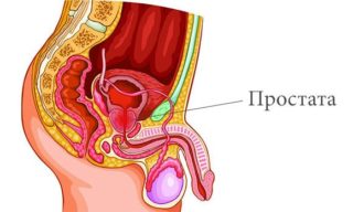 Воспаление простаты приводит к болевым ощущениям при мочеиспускании
