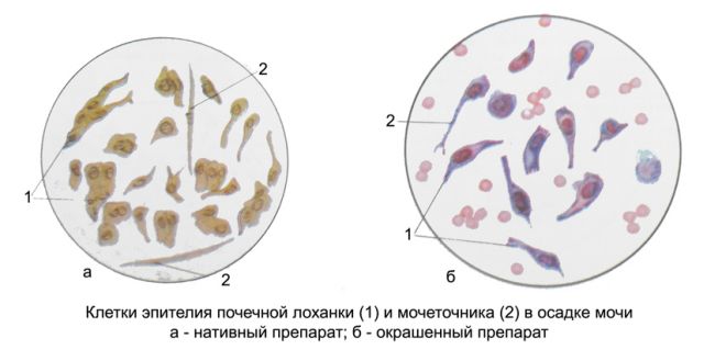 Почечный эпителий