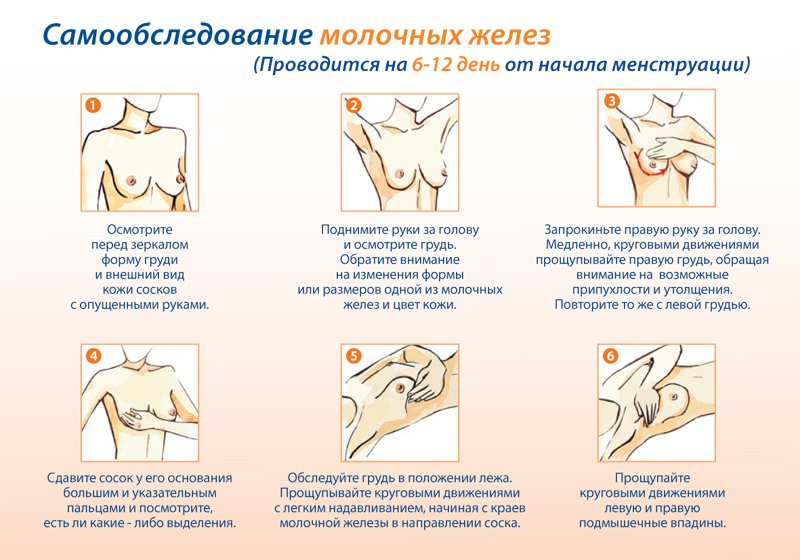 Профилактика рака молочной железы