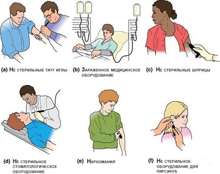 Причины заражения гепатитом B