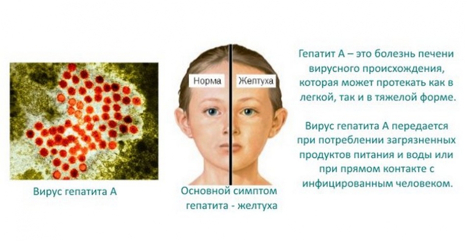 Быстрая утомляемость - симптом вирусного гепатита