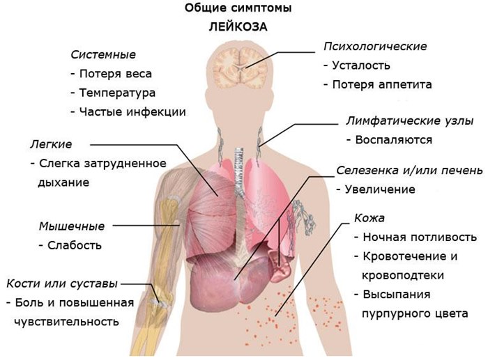 Симптомы