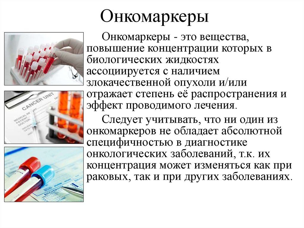 Онкомаркер CA 242: что означает, нормы, что показывает?