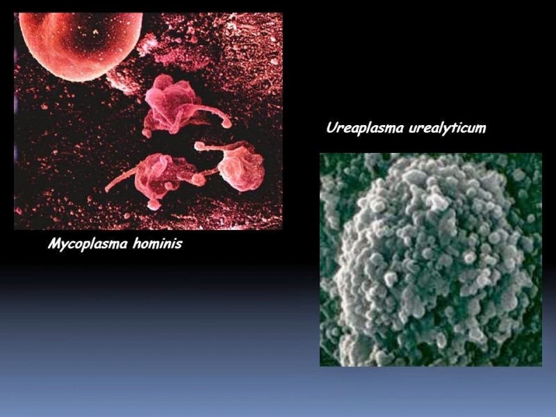 Норма ureaplasma parvum у женщин