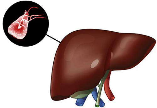 Лямблии в печени