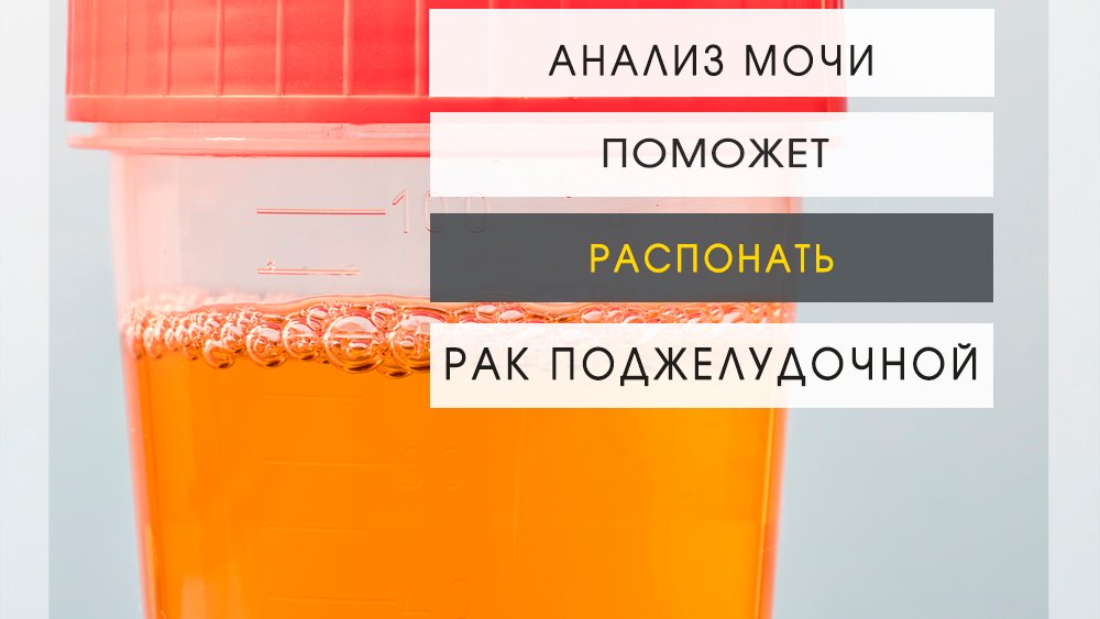 Моча красного цвета у женщины причины. Коричневый цвет мочи у женщин. Цвет мочи оранжево-розовый. Оранжево-красный цвет мочи. Моча с розовым оттенком.