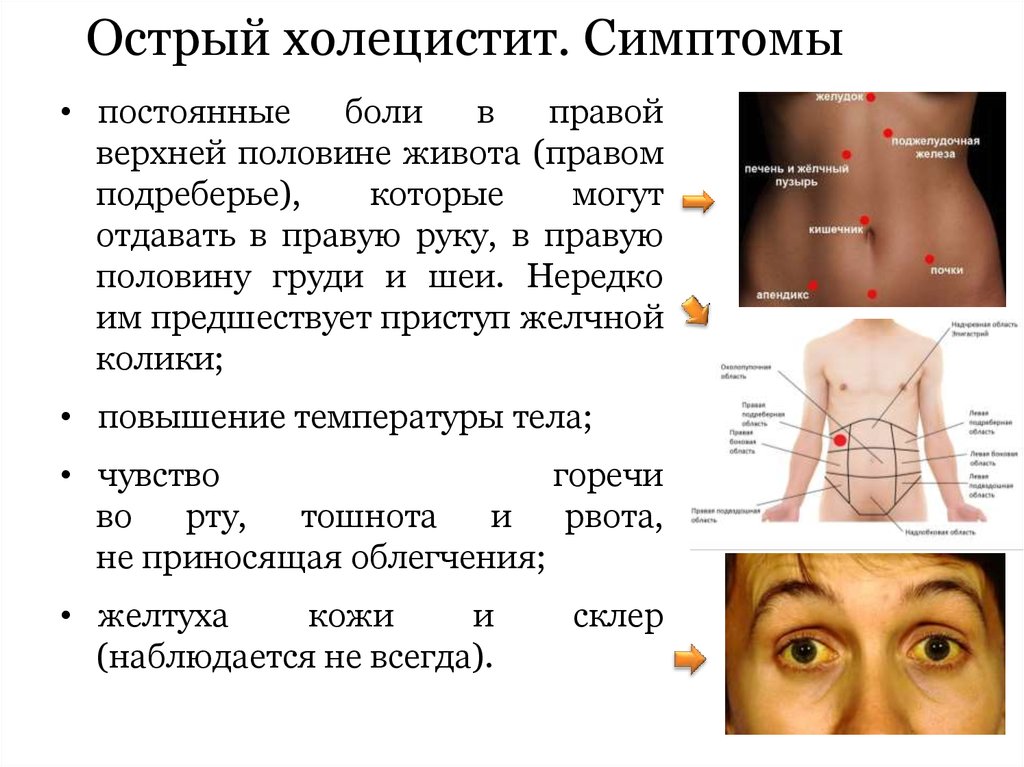 Холецистит симптомы