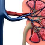 Ишемическая нефропатия: симптомы, диагностика и лечение