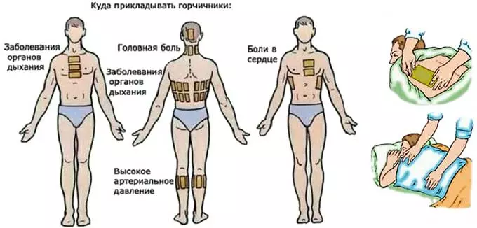 Горчичники при проблемах с давлением