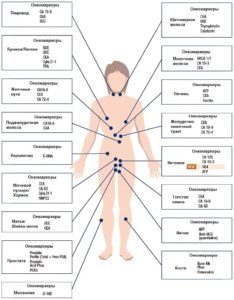 Виды онкомаркеров