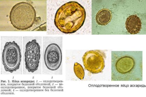 яйца человеческой аскариды