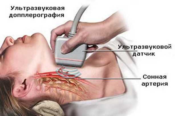 Ультразвуковое исследование сосудов