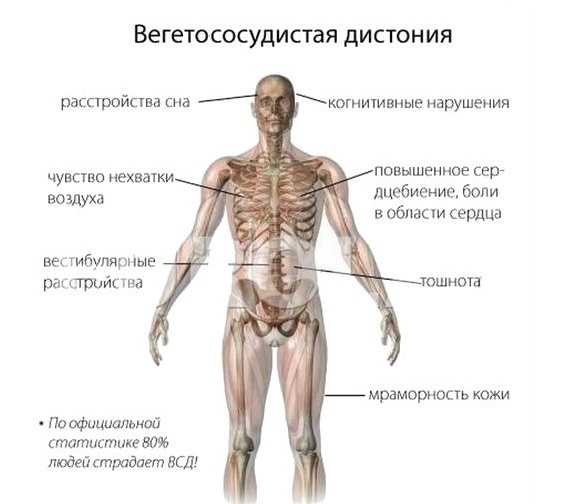 Симптомы вегетососудистой дистонии