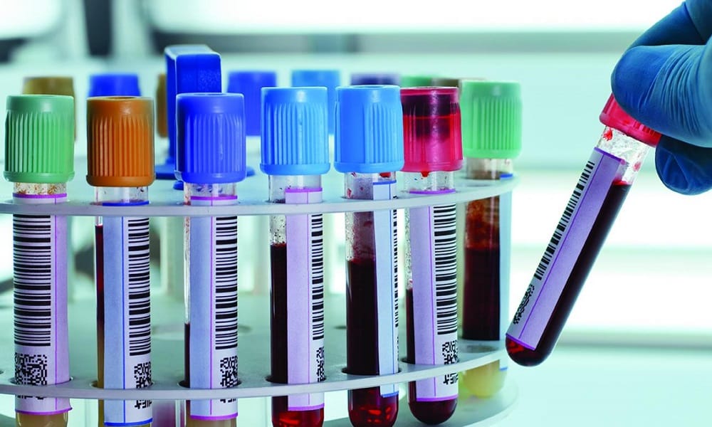 Определить наличие или отсутствие антител в организме можно с помощью иммуноферментного анализа крови