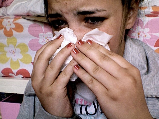 Аллергическая реакция дыхательных путей у девушки