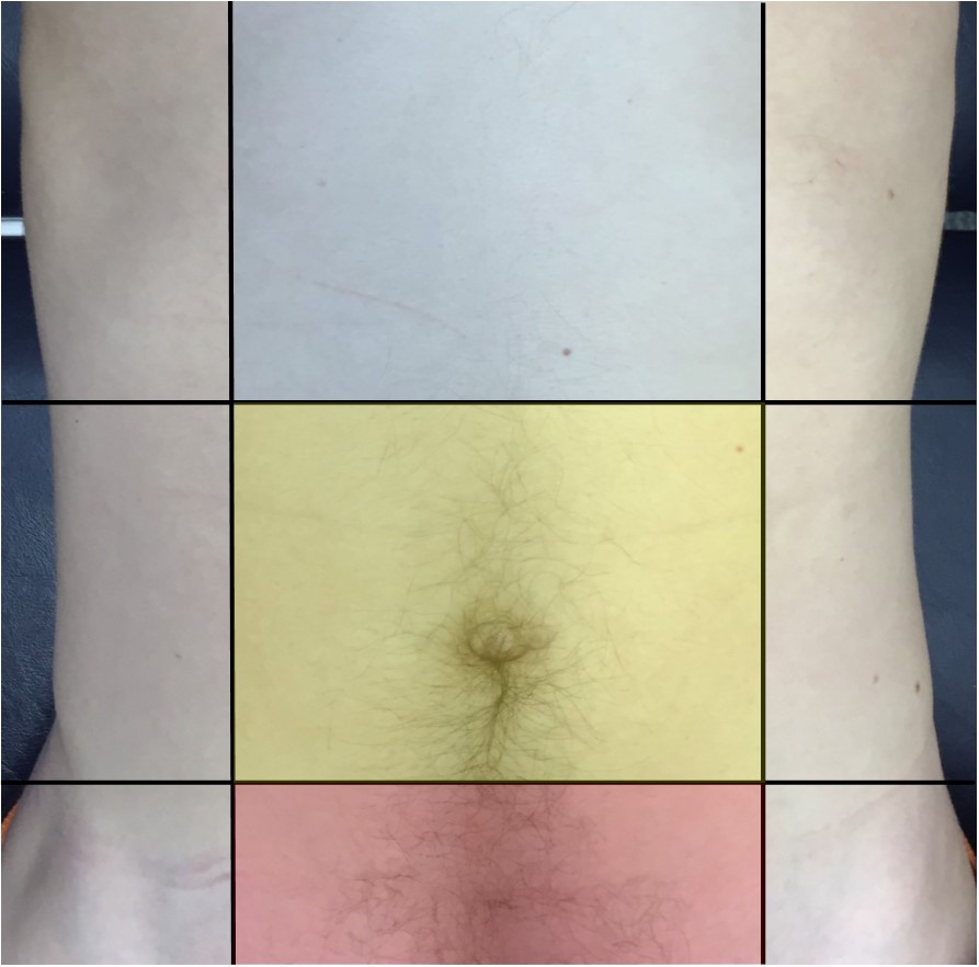 The quadrants of the abdomen.