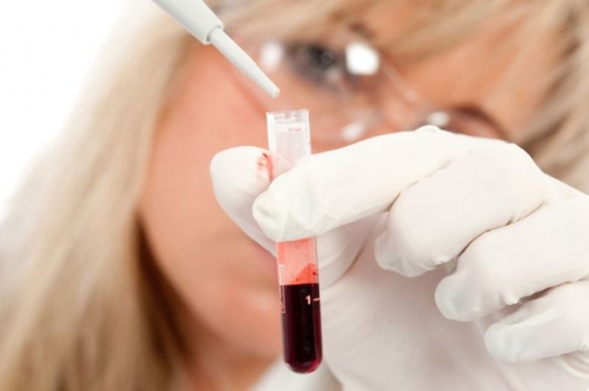 Снизить уровень лейкоцитов в крови можно лишь выяснив причину, которую вызвало их повышение