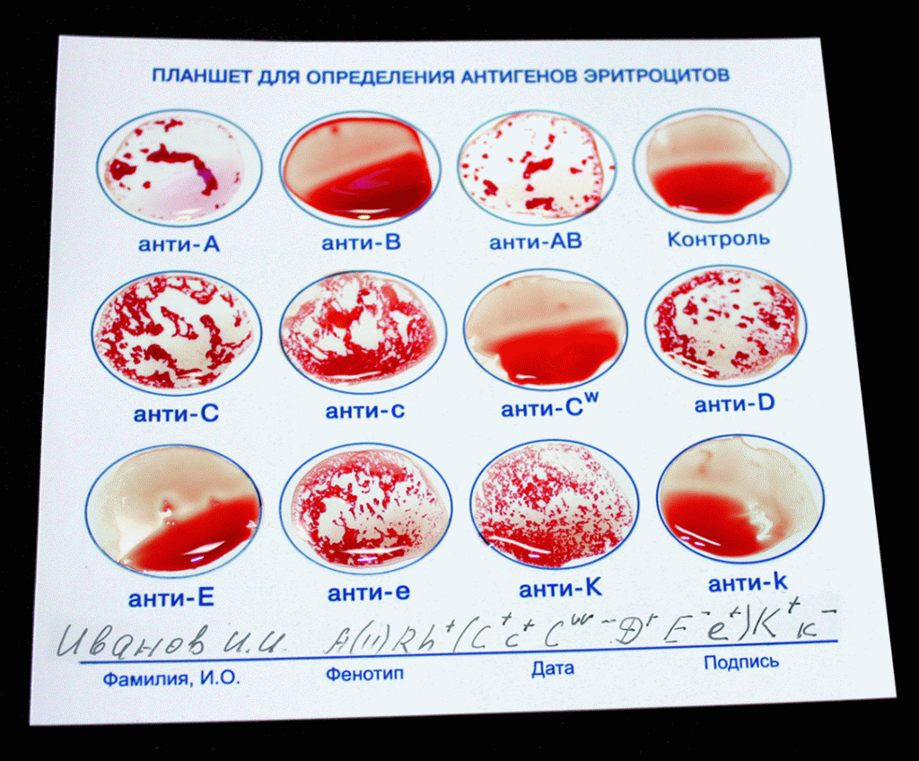 Резус-фактор