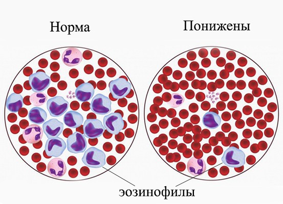 Норма эозинофилов