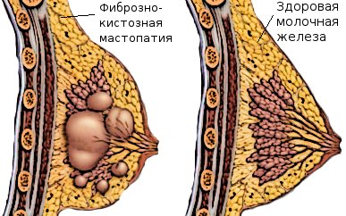 Заболевания, сопровождающиеся выделением крови