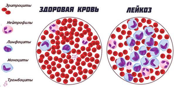 Виды заболевания