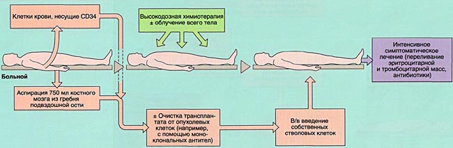 Методы лечения лейкозов