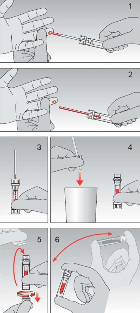 Алгоритм взятия. Техника прокола пальца для взятия капиллярной крови. Техника проведения забора капиллярной крови. Техника забора капиллярной крови для исследования. Алгоритм взятия капиллярной крови у детей.