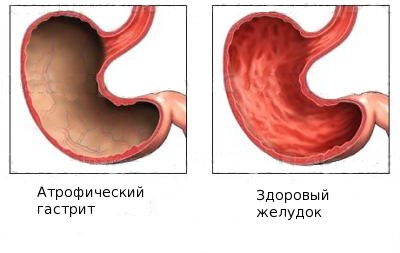 Причины заболевания и сопутствующие факторы