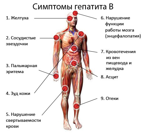 Назначение анализа