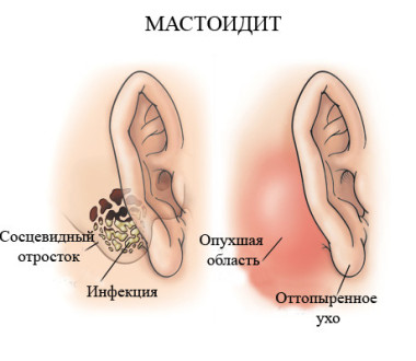 Причины кровотечения