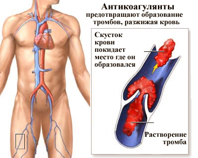 Что делать при густой крови