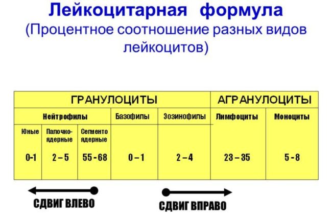 Сдвиг лейкоцитарной формулы