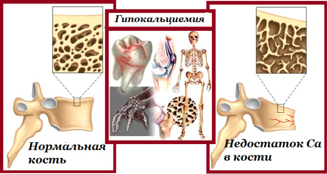 Анализ на уровень содержания кальция