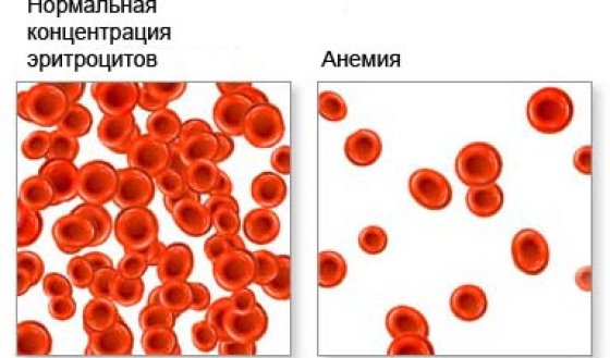 Разновидности и стадии