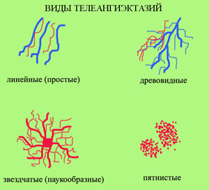 Причины